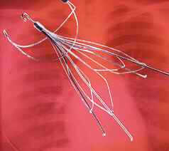 Bard IVC Filters – Problems With The FDA