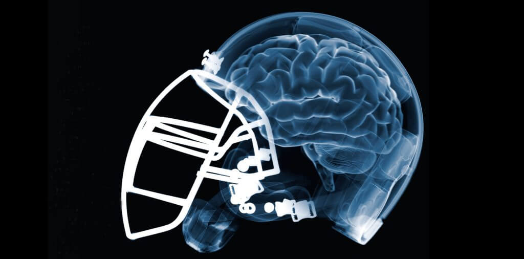 NCAA Concussion Lawsuits Filed